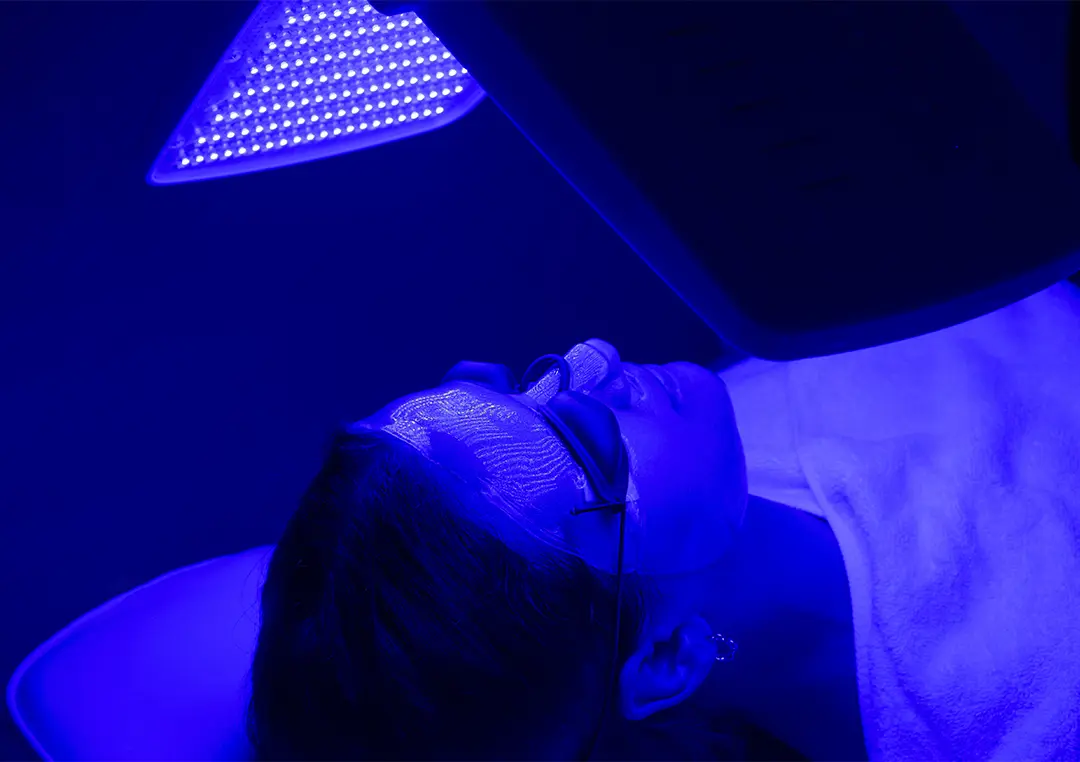 Blu-U Light Treatments San Antonio | DaVida Medical & Aesthetics