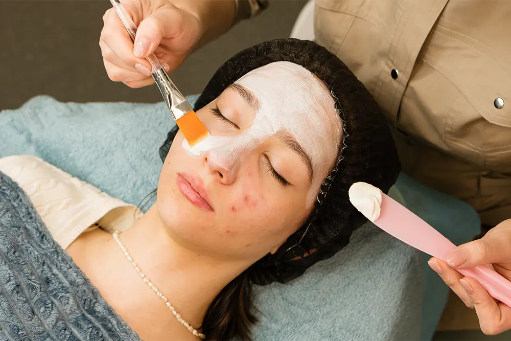 Best Acne Treatment San Antonio | DaVida Medical & Aesthetics