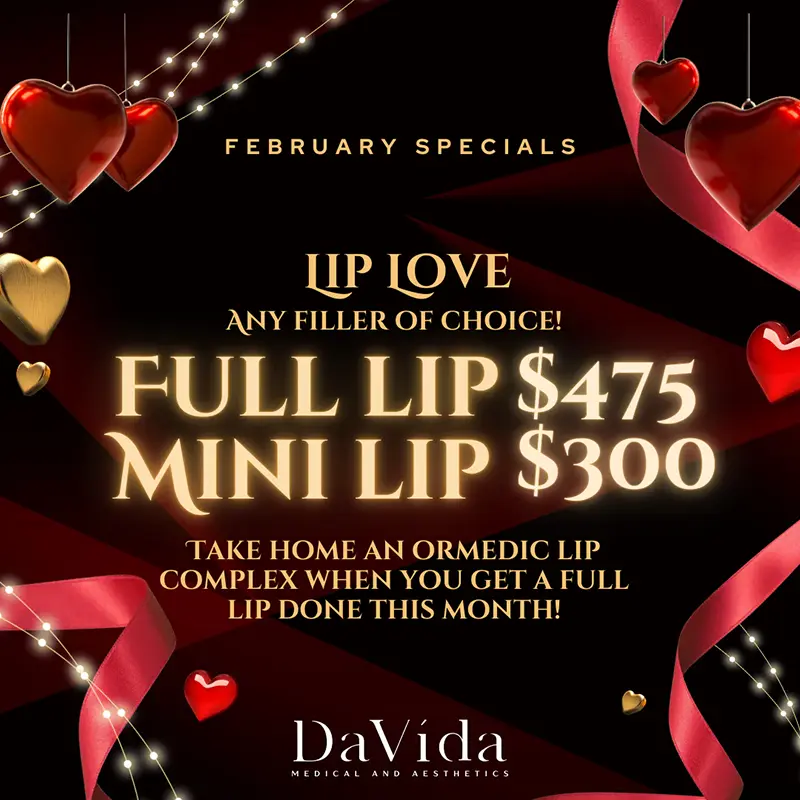 Lip Filler Med Spa Valentine's Day Special