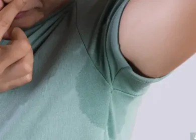 Hyperhidrosis: Stop the Sweat with Botox or Brella