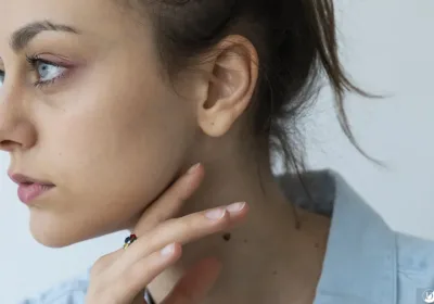 What Causes Skin Tags on the Neck?