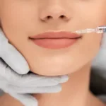Get Kissable Lips with Restylane Kysse Treatment in San Antonio