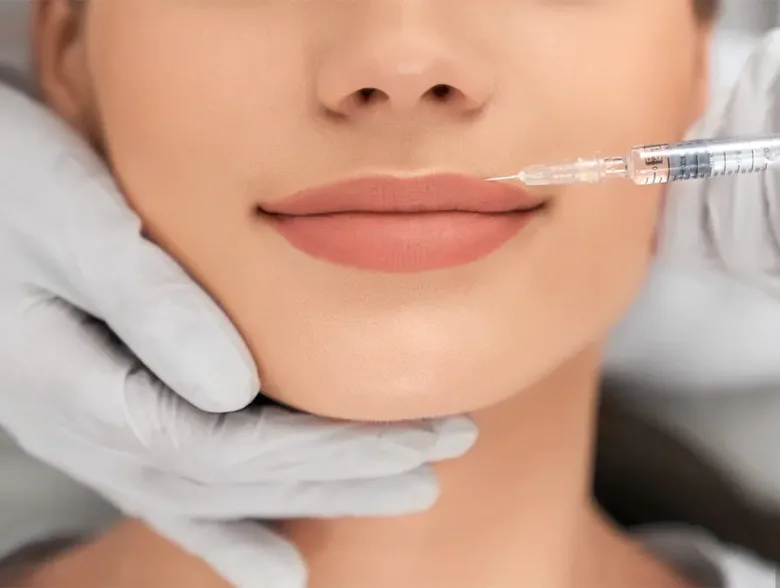 Get Kissable Lips with Restylane Kysse Treatment in San Antonio