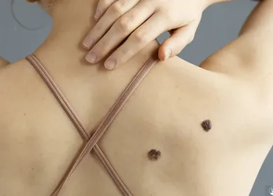 Full Skin Exam in San Antonio | DaVida Medical & Aesthetics