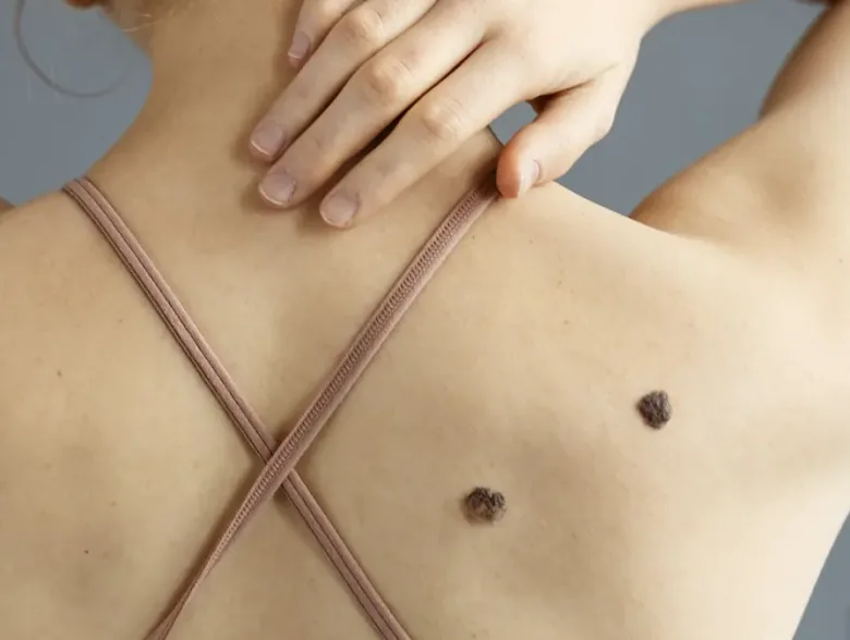 Full Skin Exam in San Antonio | DaVida Medical & Aesthetics