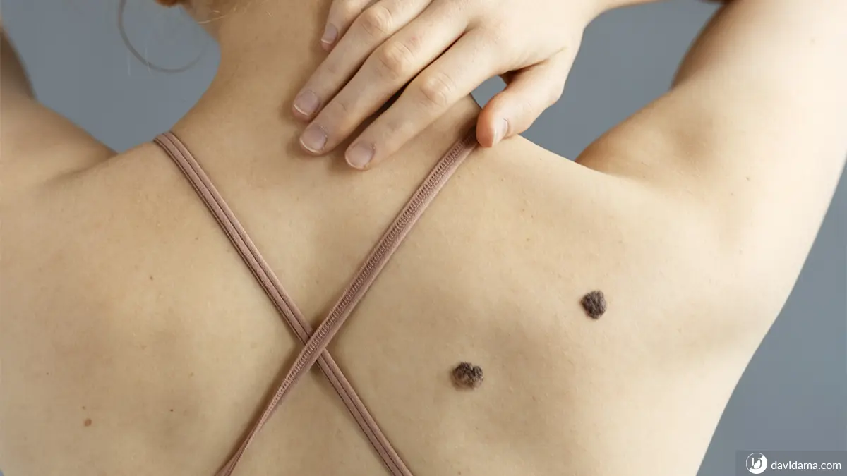 Full Skin Exam in San Antonio | DaVida Medical & Aesthetics