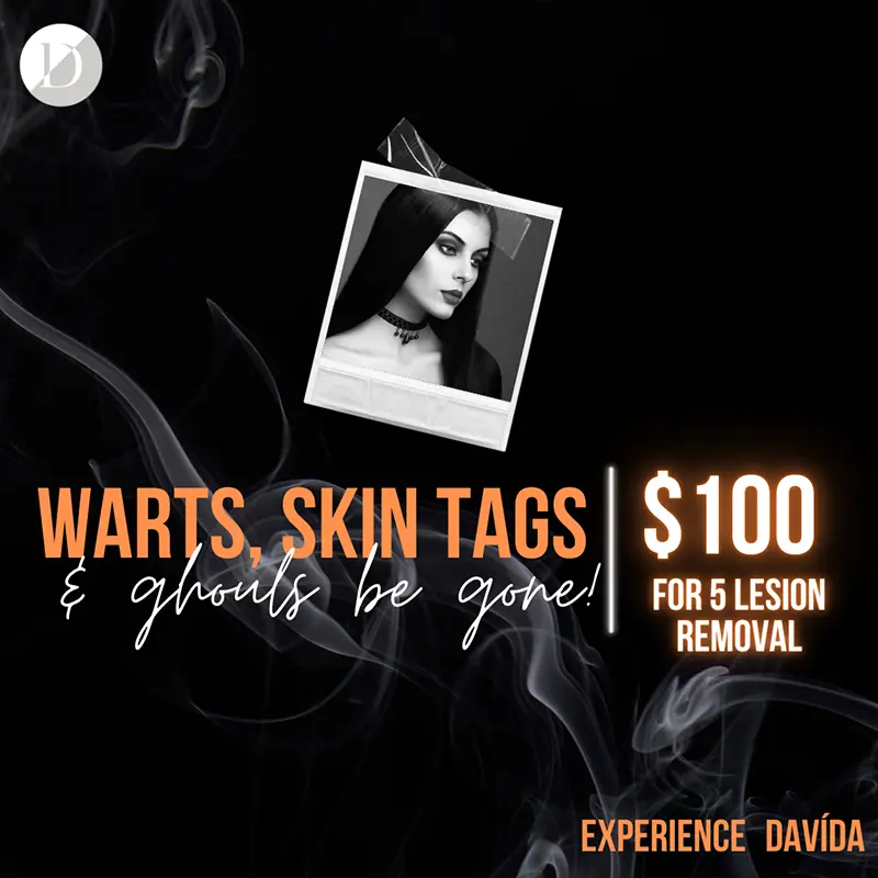 Skin Tags and Wart Removal Med Spa Special