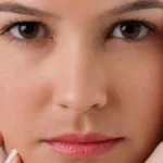 Benefits of RF Microneedling at DaVida Medical & Aesthetics