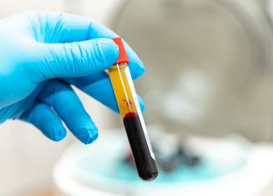 Blood draw for PRF treatment as part of a prf vs prp under eyes procedure