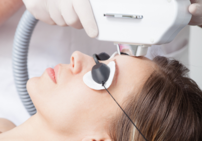 Woman receiving an IPL laser facial treatment during a benefits of IPL laser skincare session