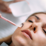 Woman receiving a professional chemical peel as part of an educational guide about facial frosting