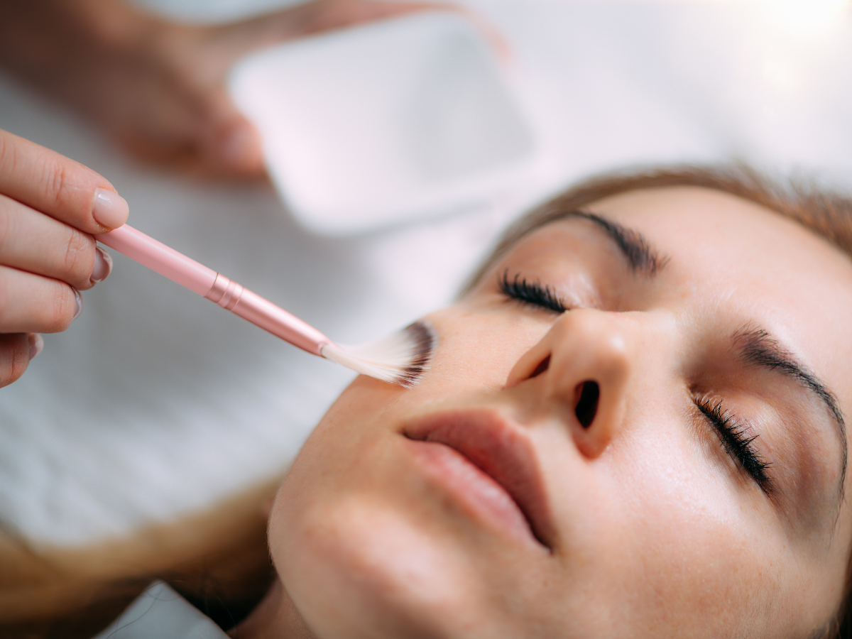 Woman receiving a professional chemical peel as part of an educational guide about facial frosting