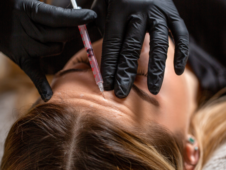 Woman receiving forehead Botox injections during Sculptra vs Botox injectable facial rejuvenation treatment consultation