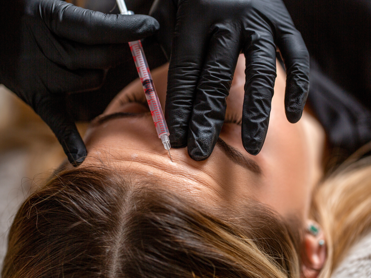 Woman receiving forehead Botox injections during Sculptra vs Botox injectable facial rejuvenation treatment consultation