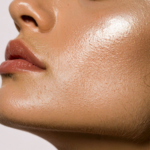 Side profile showing softened jaw contour after masseter Botox