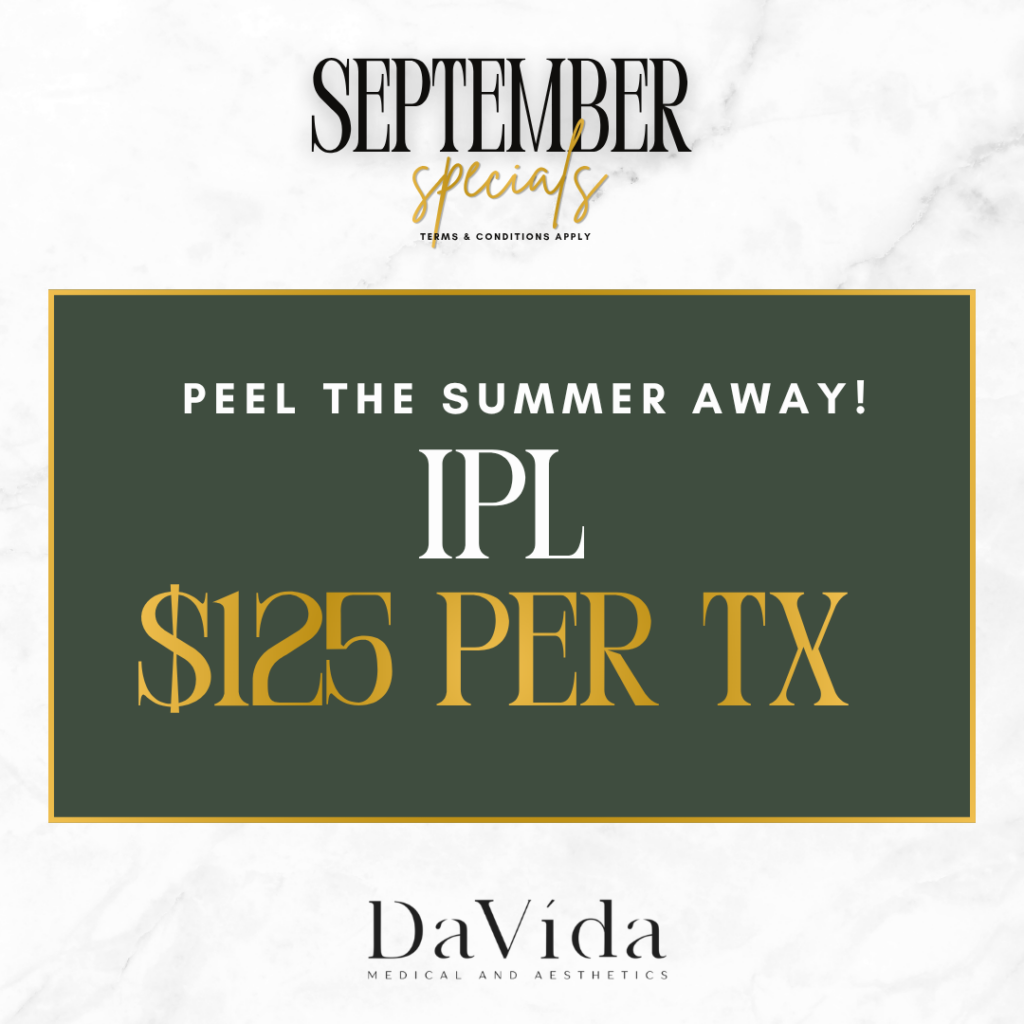 September special flyer — IPL photofacial for $125 per treatment at DaVida in San Antonio, peel the summer away.
