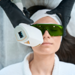Woman receiving laser hair removal on her upper lip at a San Antonio med spa