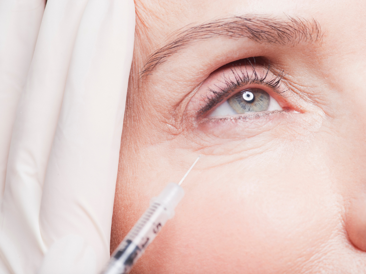 Provider injecting under-eye filler into a client's tear trough with a cannula