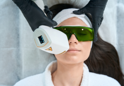 Woman receiving laser hair removal on her upper lip at a San Antonio med spa