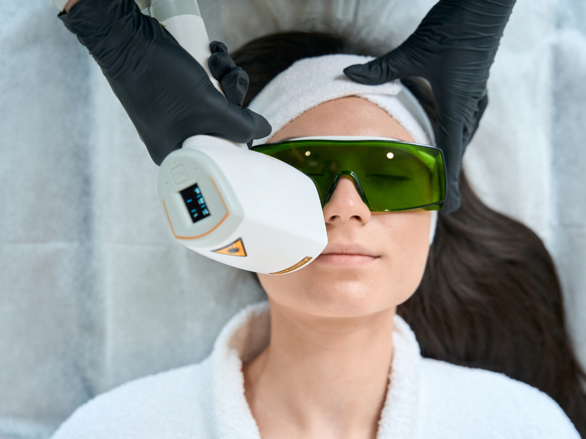 Woman receiving laser hair removal on her upper lip at a San Antonio med spa