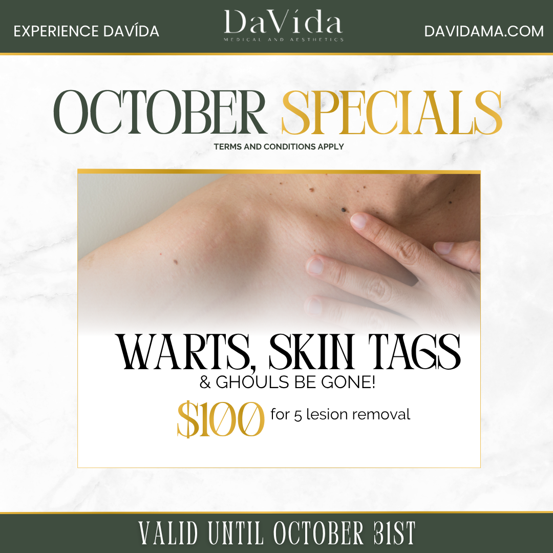October special flyer — Warts, Skin Tags & Ghouls Be Gone, $100 for removal of 5 lesions at DaVida Medical and Aesthetics in San Antonio.
